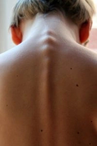 A person's neck area from the back.