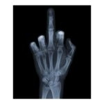 Αυτοκόλλητο Πλακάκι X-RAY