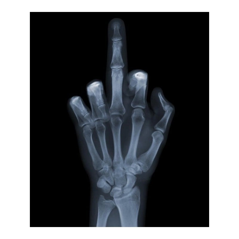 Αυτοκόλλητο Πλακάκι X-RAY